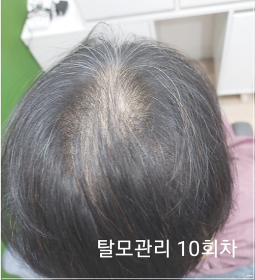 인천 예쁘미 스킨 두피 케어 이미지
