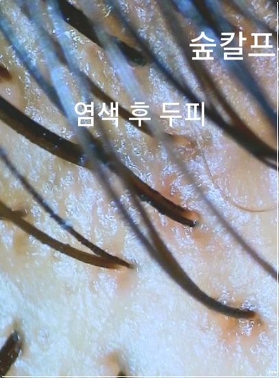 예쁘미 스킨&두피탈모 대표 이미지