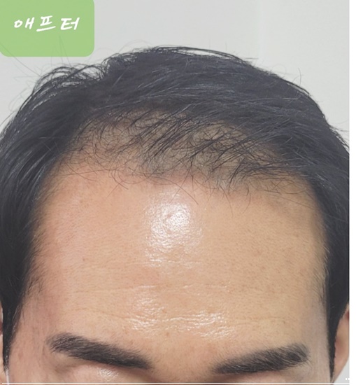 예쁘미 스킨&두피탈모 대표 이미지