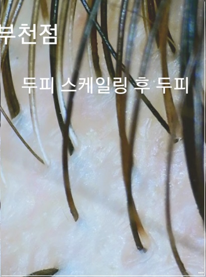 예쁘미 스킨&두피탈모 이미지