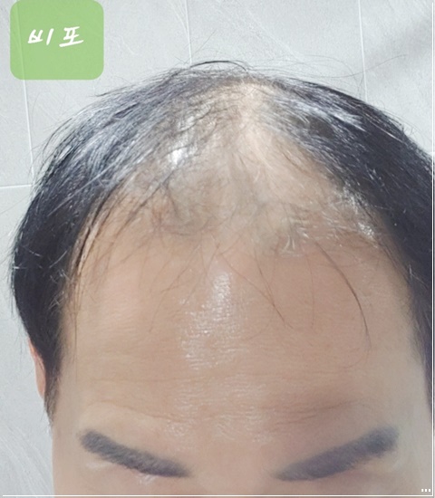 예쁘미 스킨&두피탈모 대표 이미지
