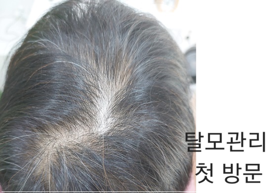 예쁘미 스킨&두피탈모 대표 이미지