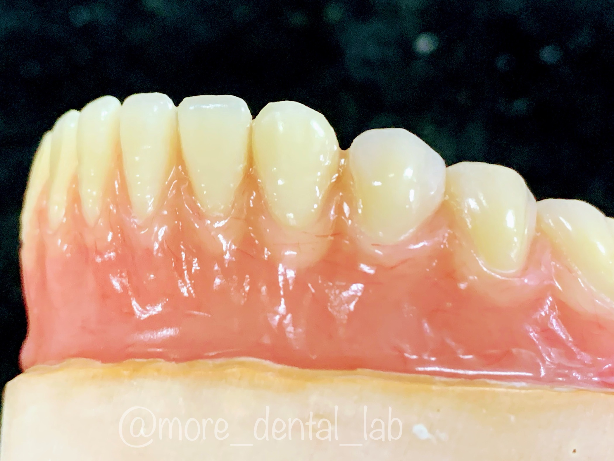 MORE치과기공소 대표 이미지