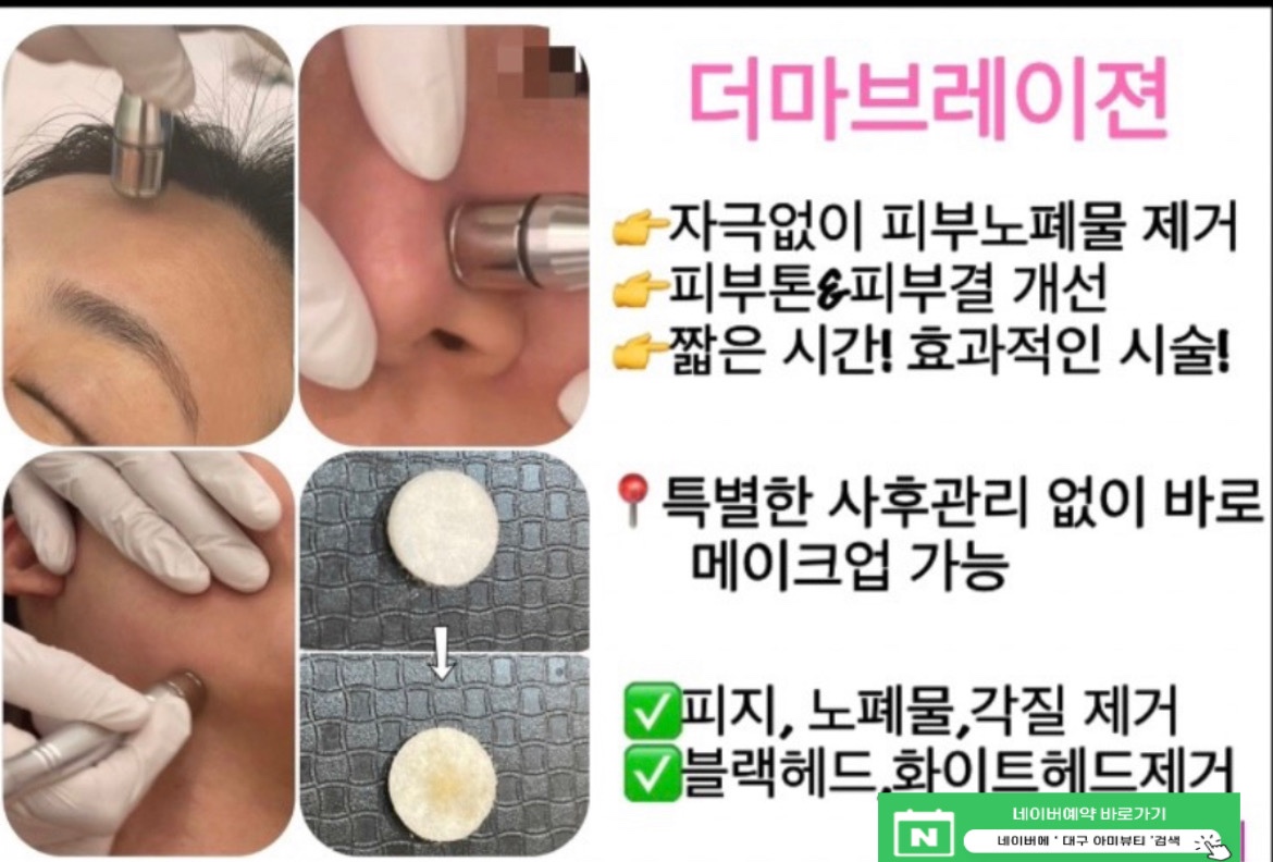 콜드플라즈마지사 아미뷰티 아카데미