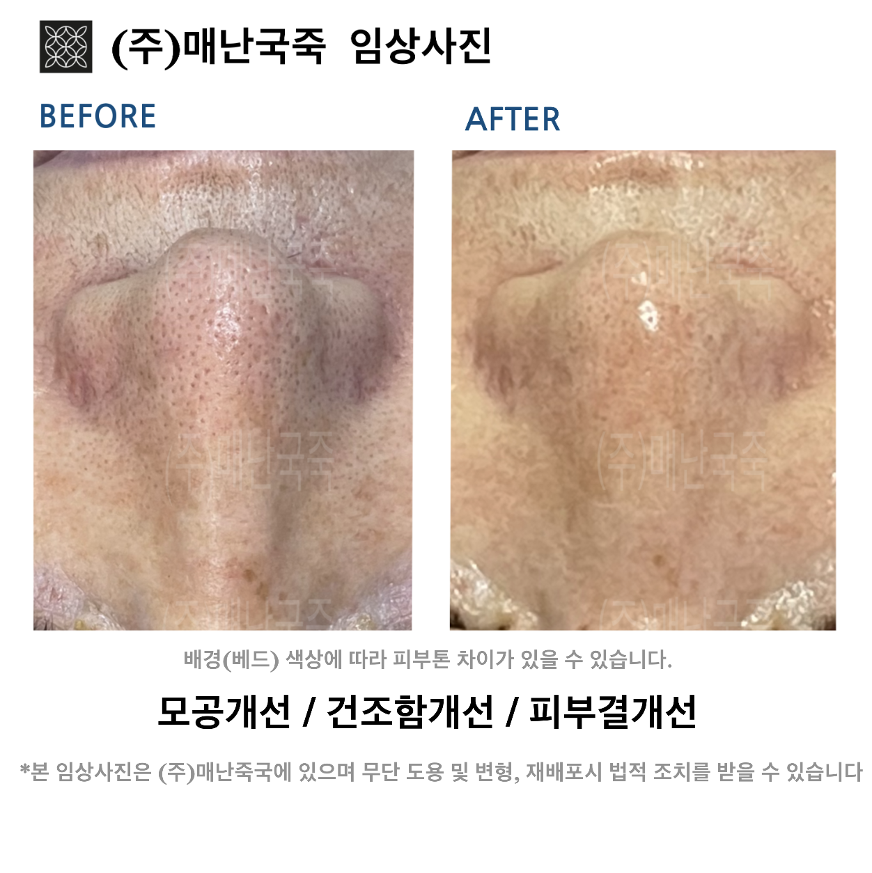 단미스킨앤바디