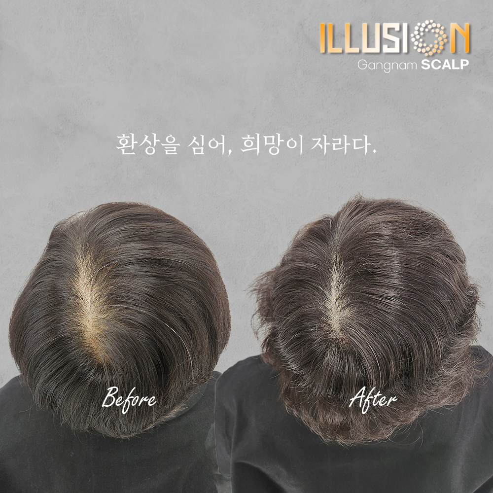 일루젼스칼프 제이든