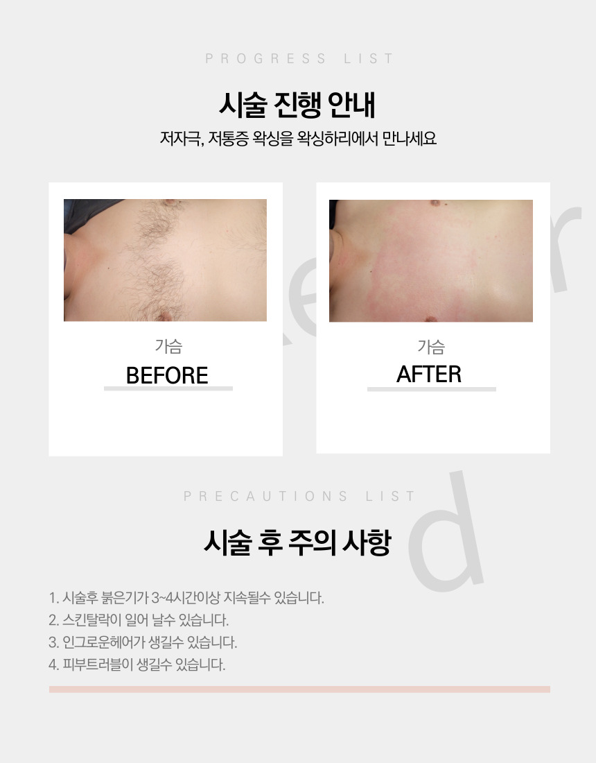 헤어하리