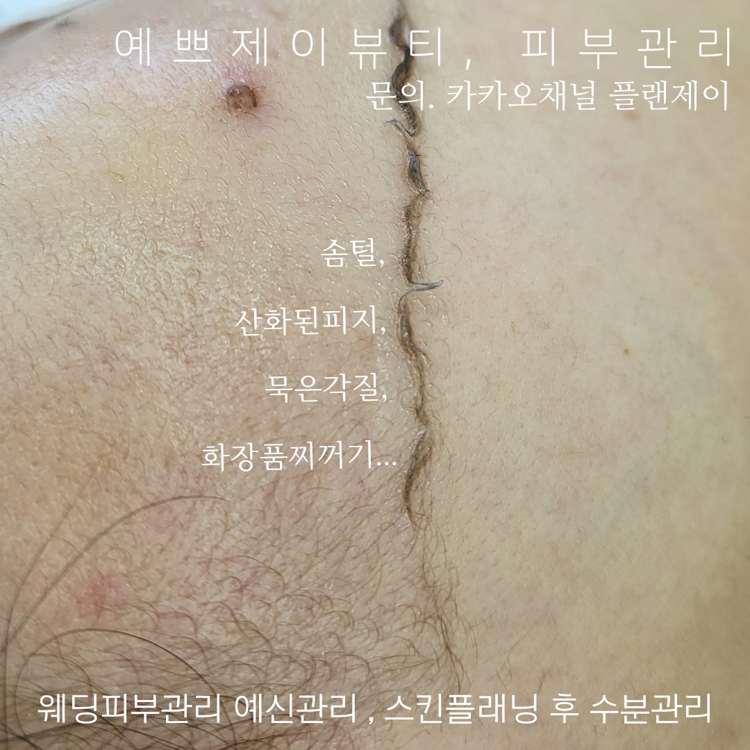 예쁘제이뷰티