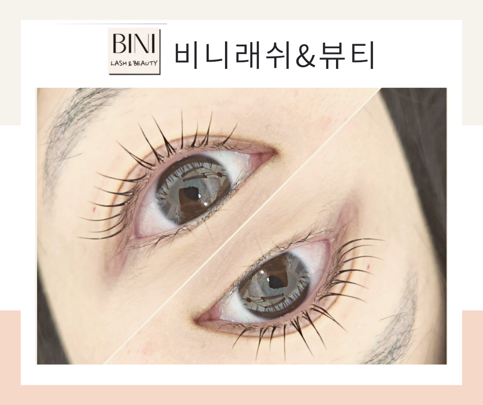 비니래쉬앤뷰티