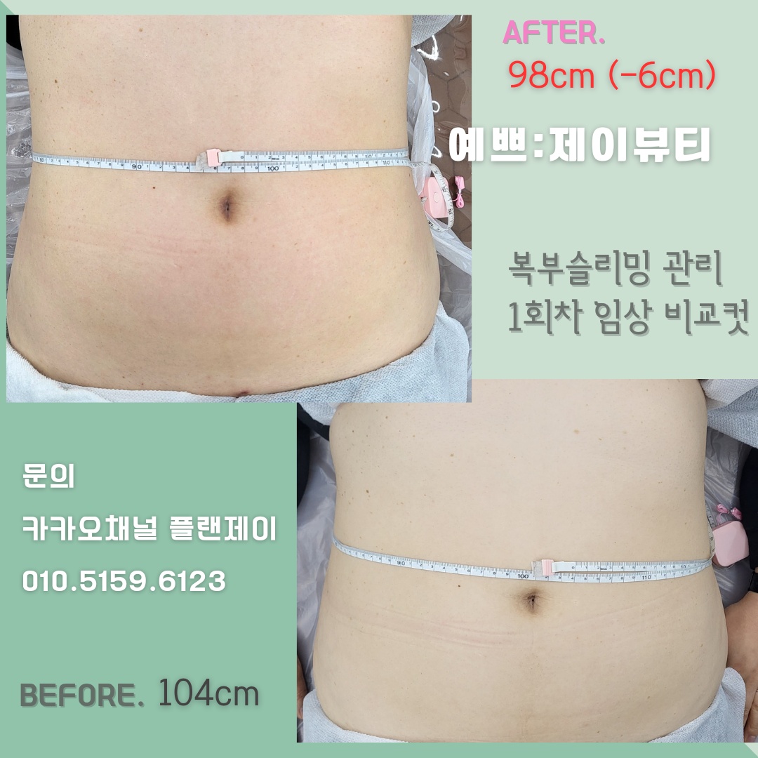 예쁘제이뷰티