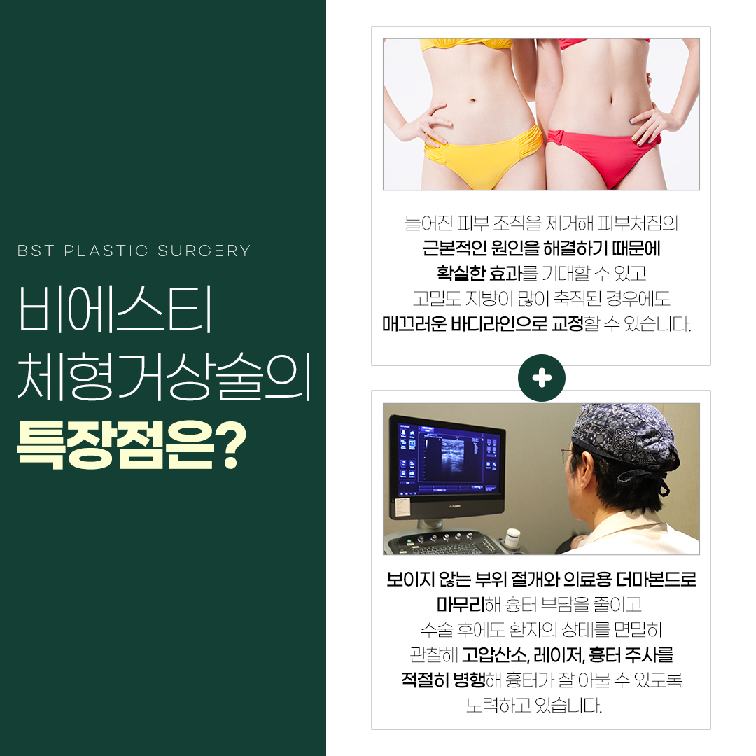 비에스티성형외과의원 대표 이미지
