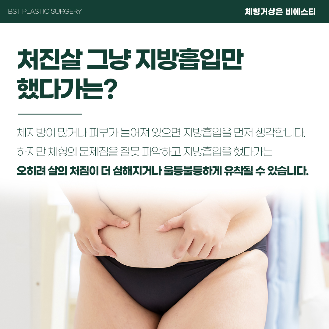 비에스티성형외과 대표 이미지