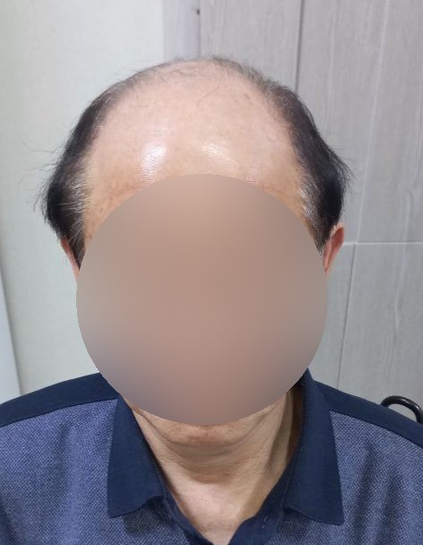 권진희가발 대표 이미지