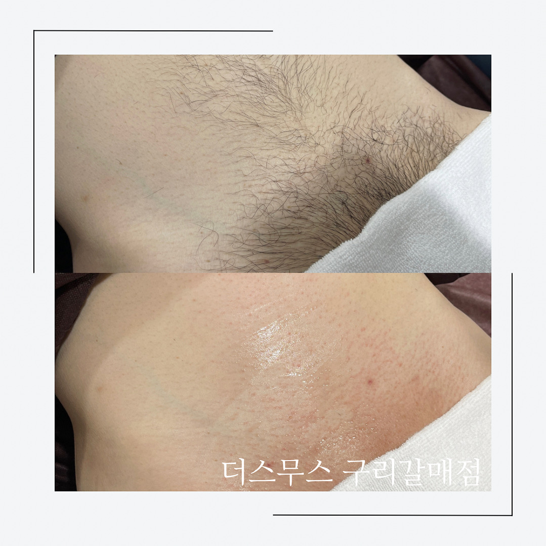 더스무스 왁싱피부 구리갈매점