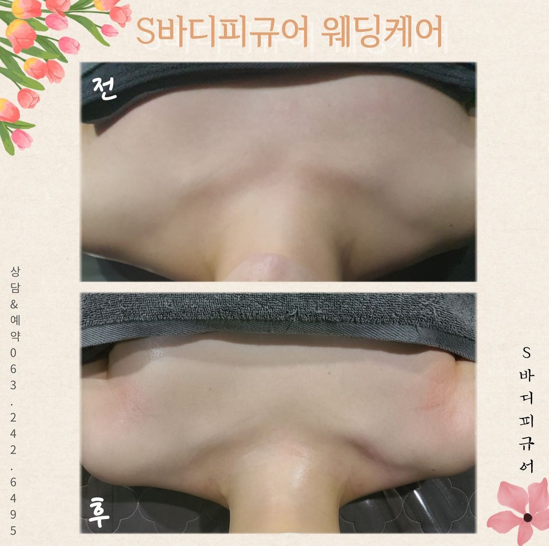 S바디피규어 피부 체형관리 photo 10
