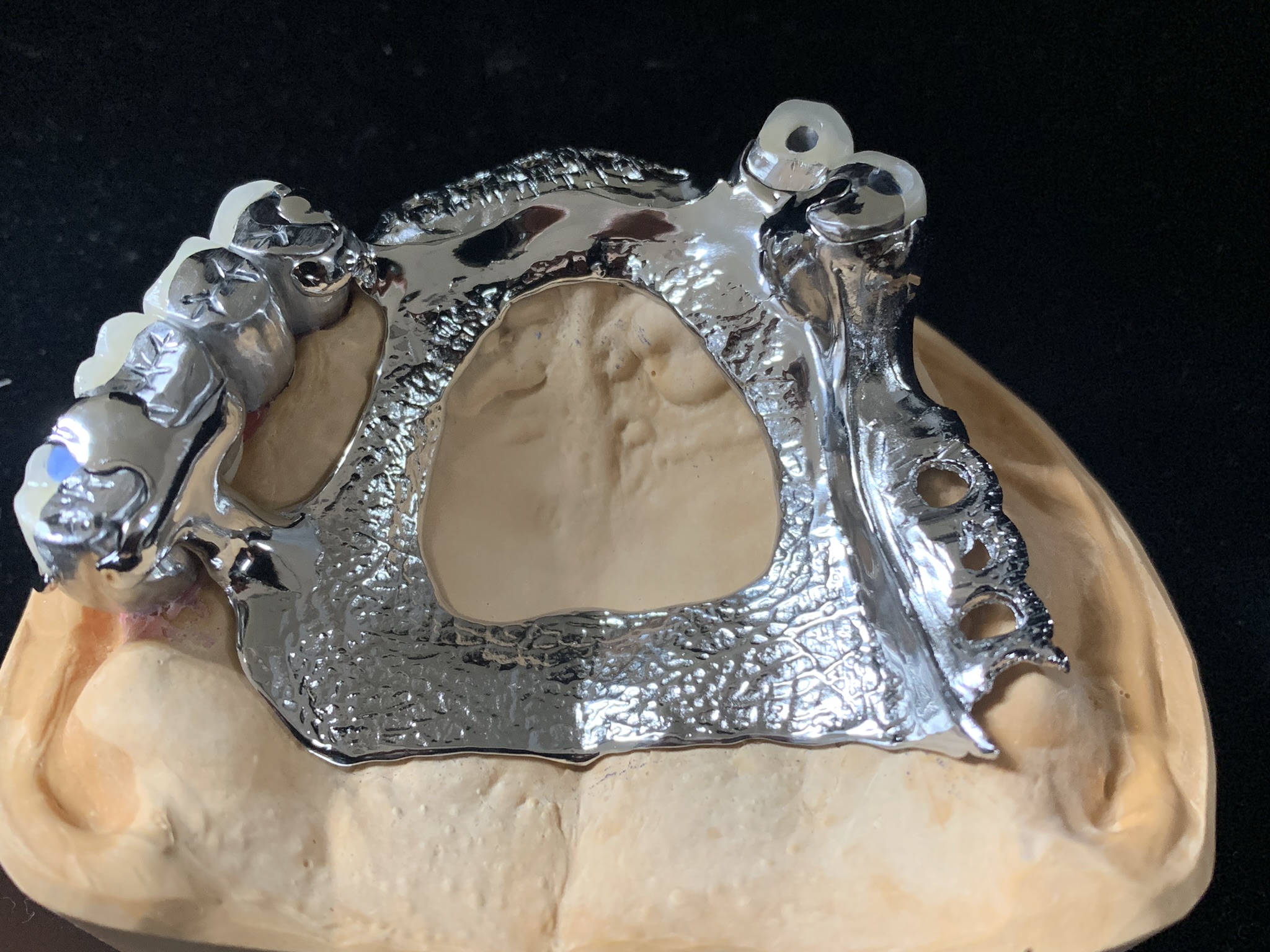 MORE치과기공소 대표 이미지