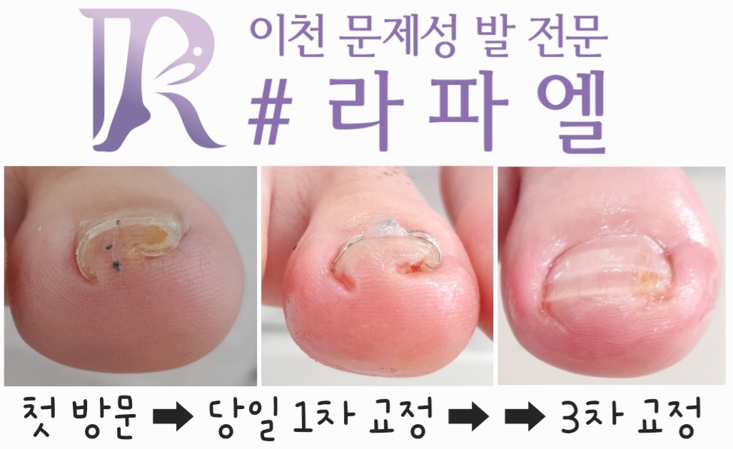 라파엘 대표 이미지