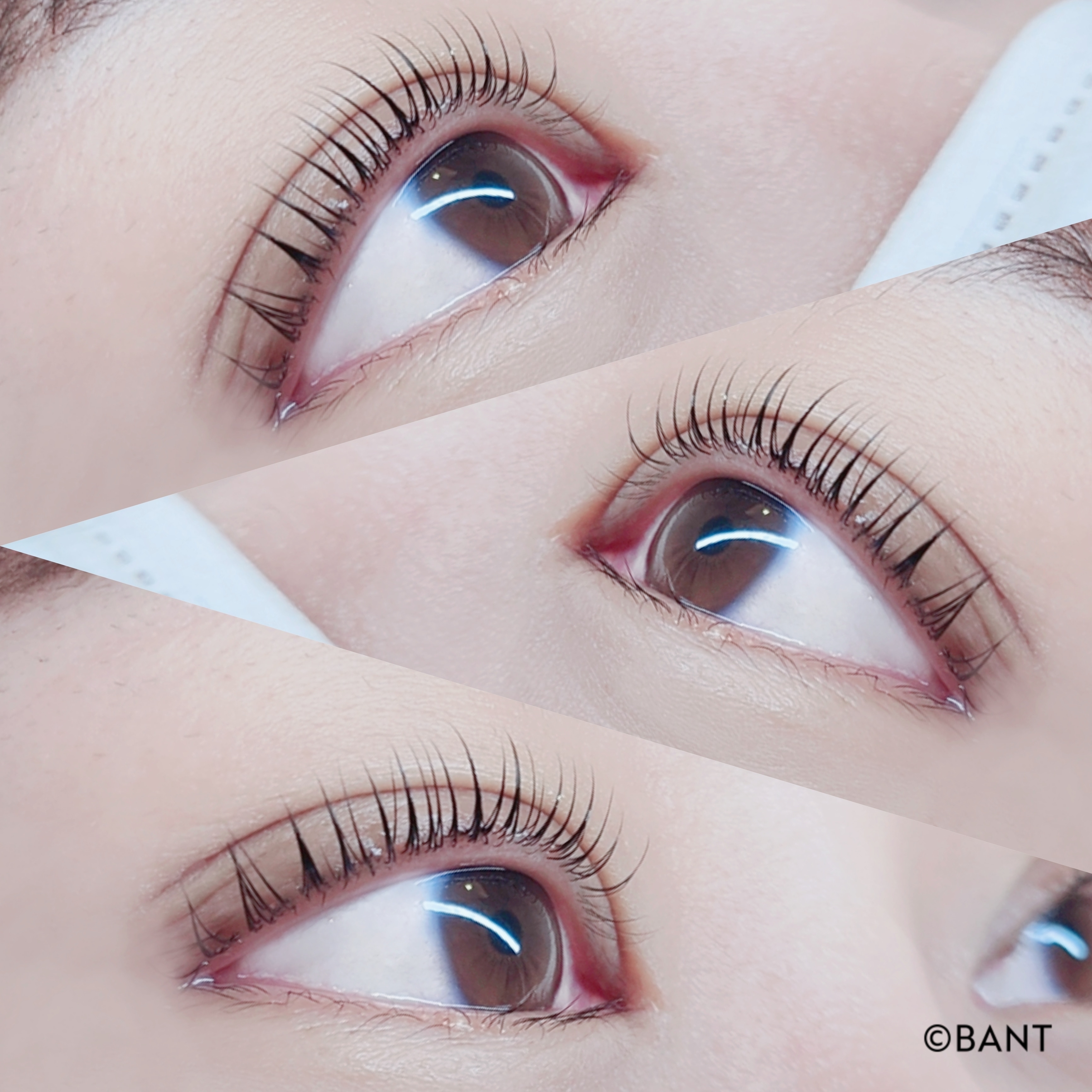 반트 대표 이미지