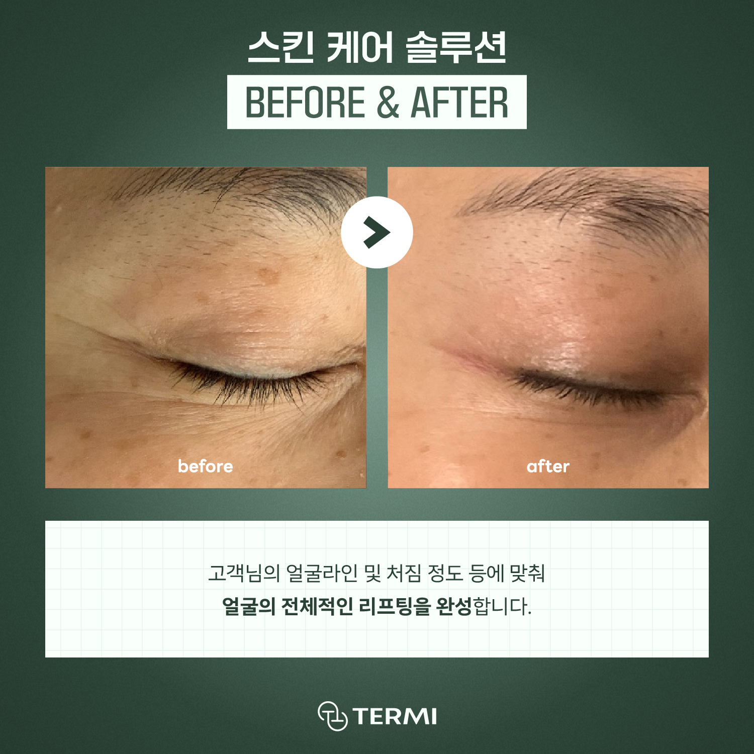 테르미 대전도안점