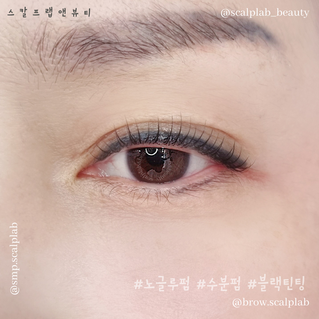 스칼프랩앤뷰티