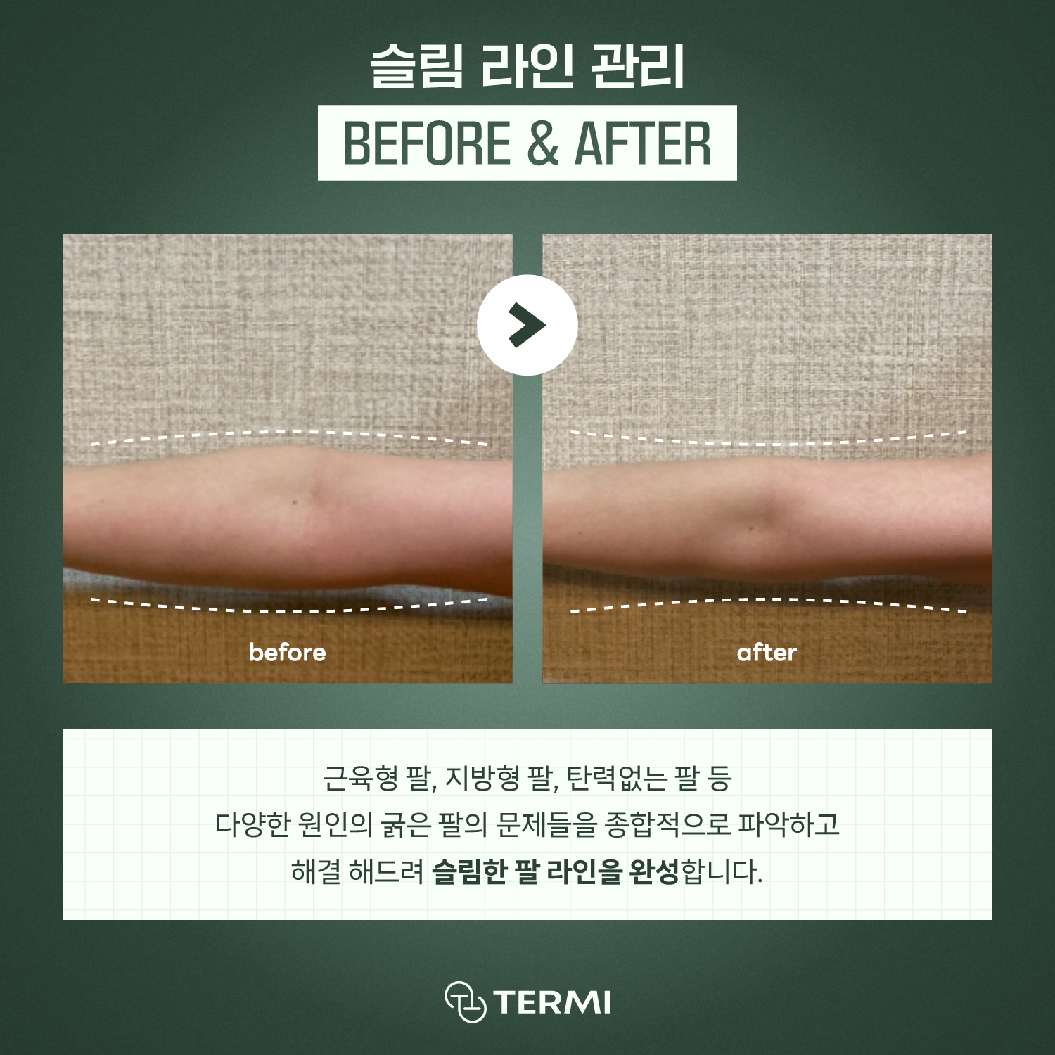 테르미 대전도안점