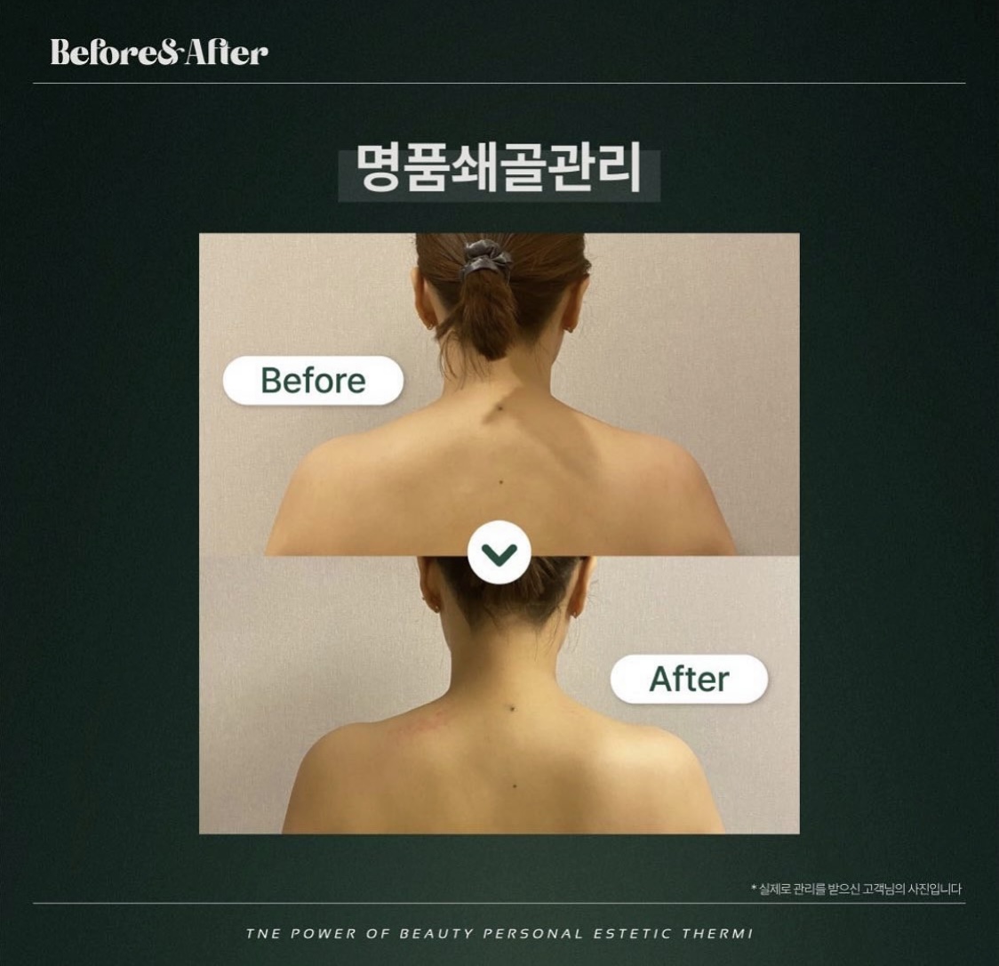 테르미 대전도안점