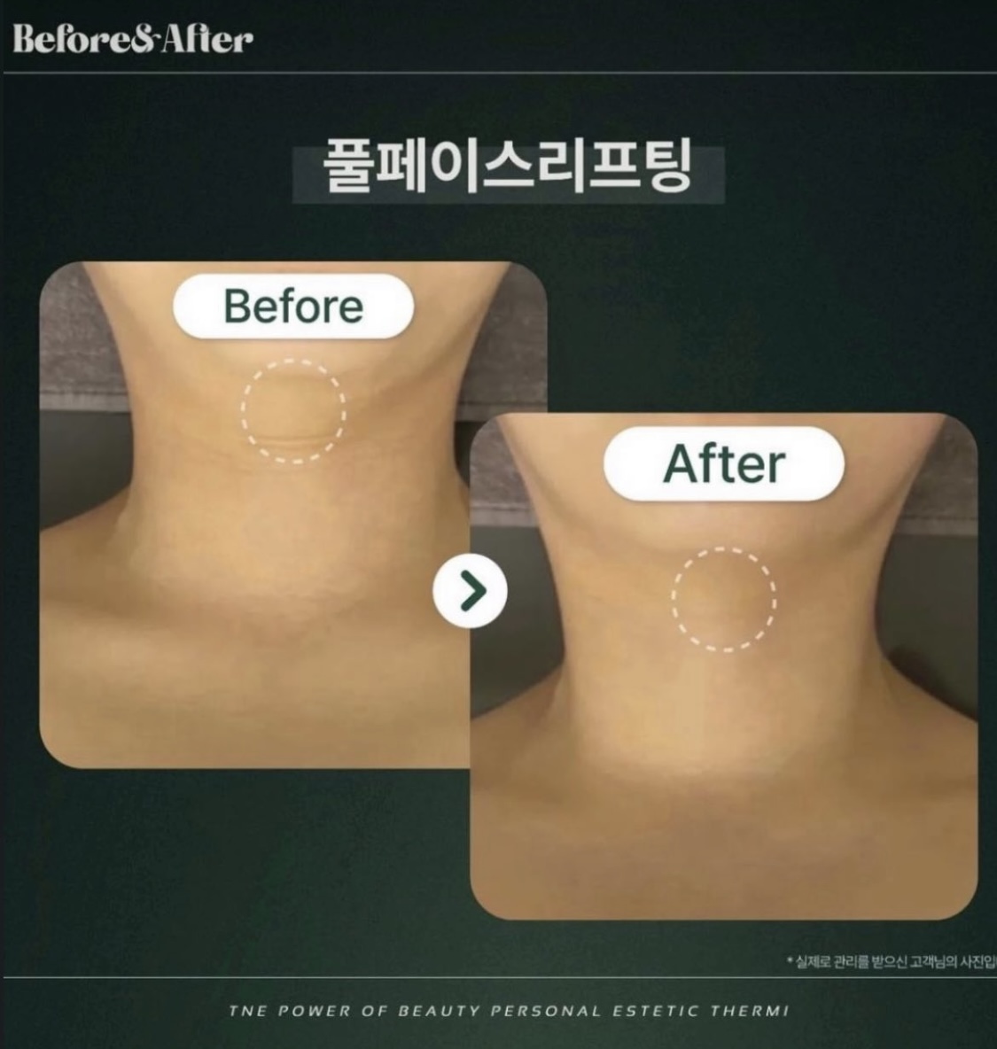 테르미 대전도안점