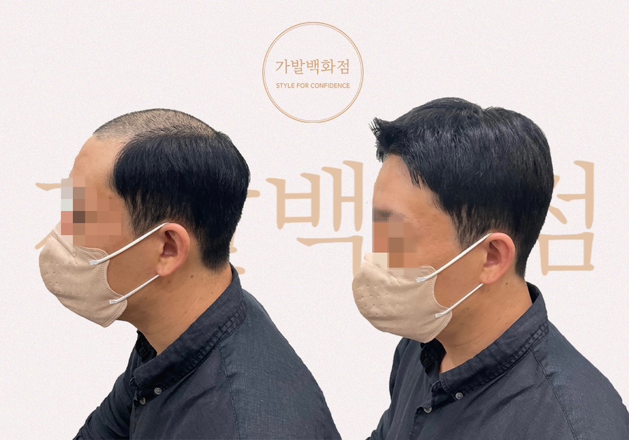 가발백화점 대표 이미지