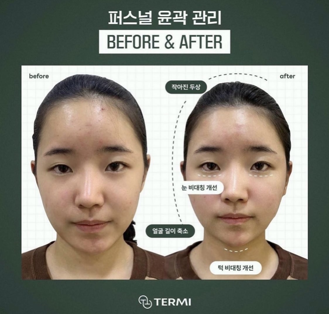 테르미 대전도안점