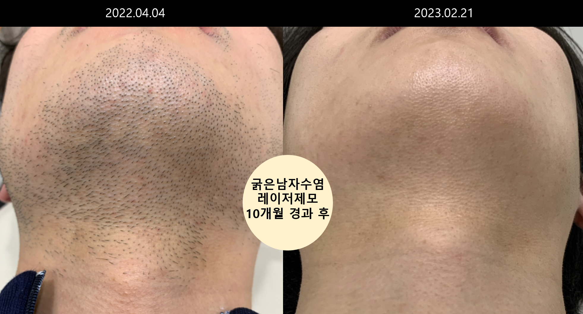 천안스노우의원 불당점 대표 이미지