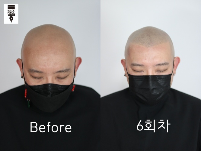블랙펜슬SMP 대표 이미지