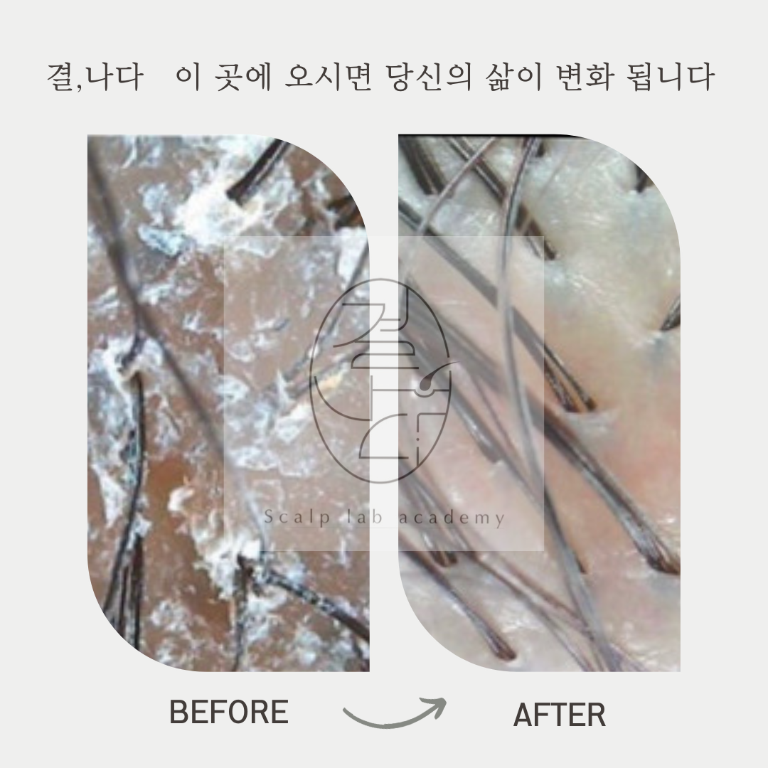 결나다