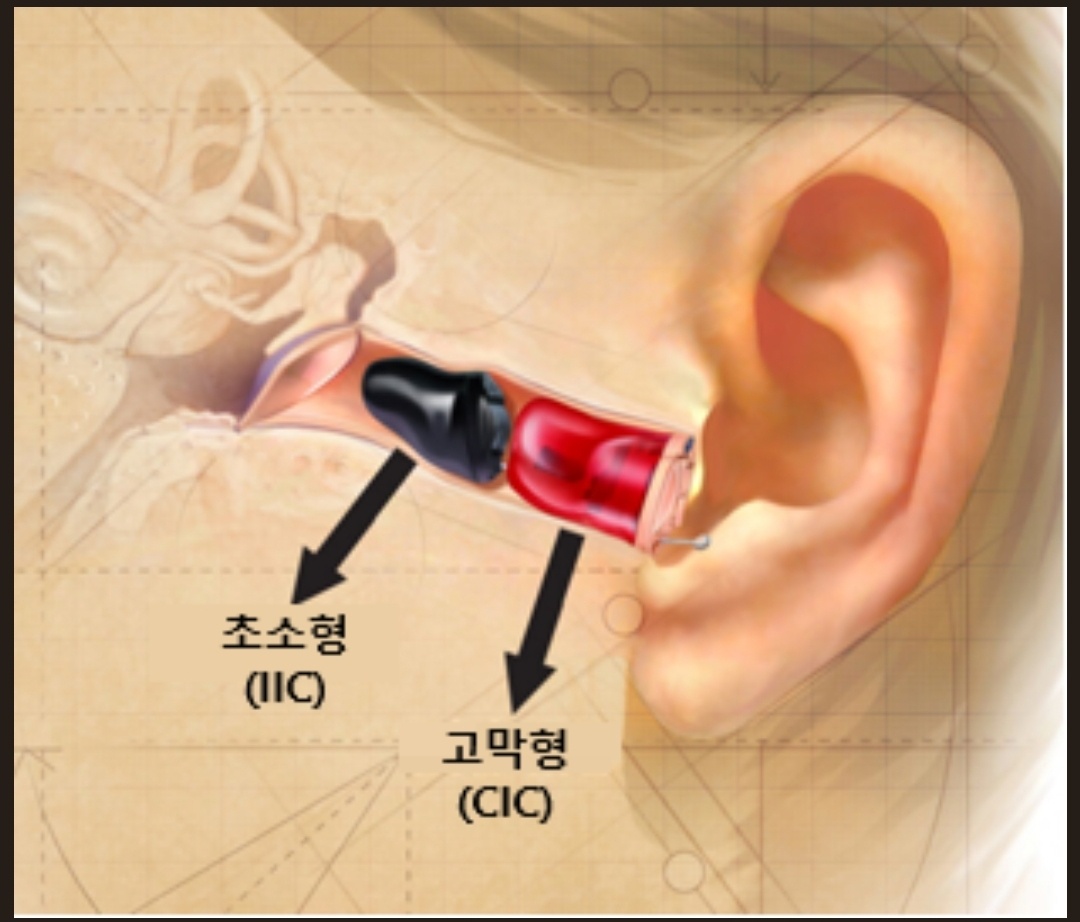 뉴톤보청기 안양센터 대표 이미지