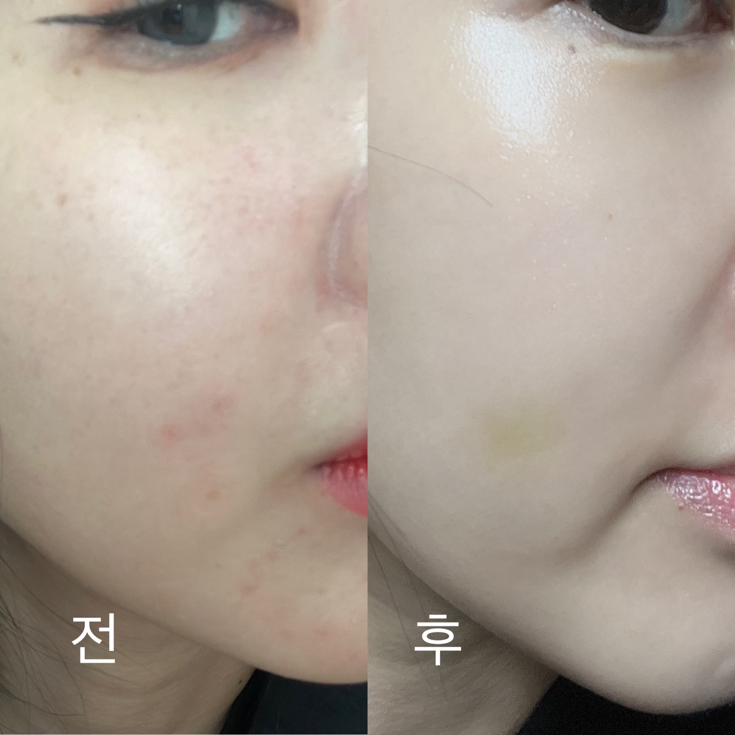 이다메뷰티 photo 8