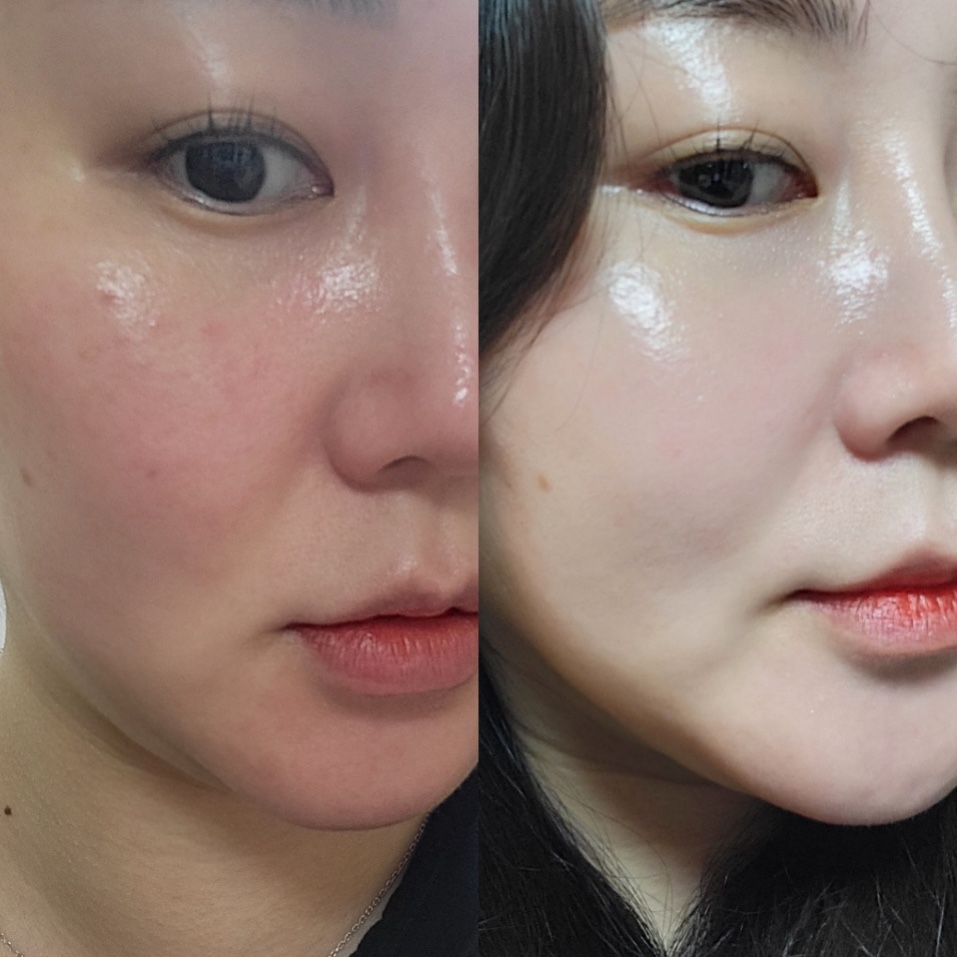 이다메뷰티 photo 9