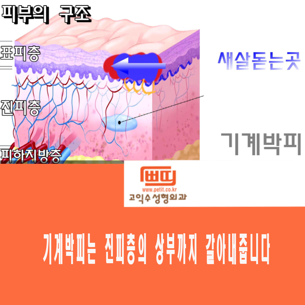 고익수성형외과의원 대표 이미지