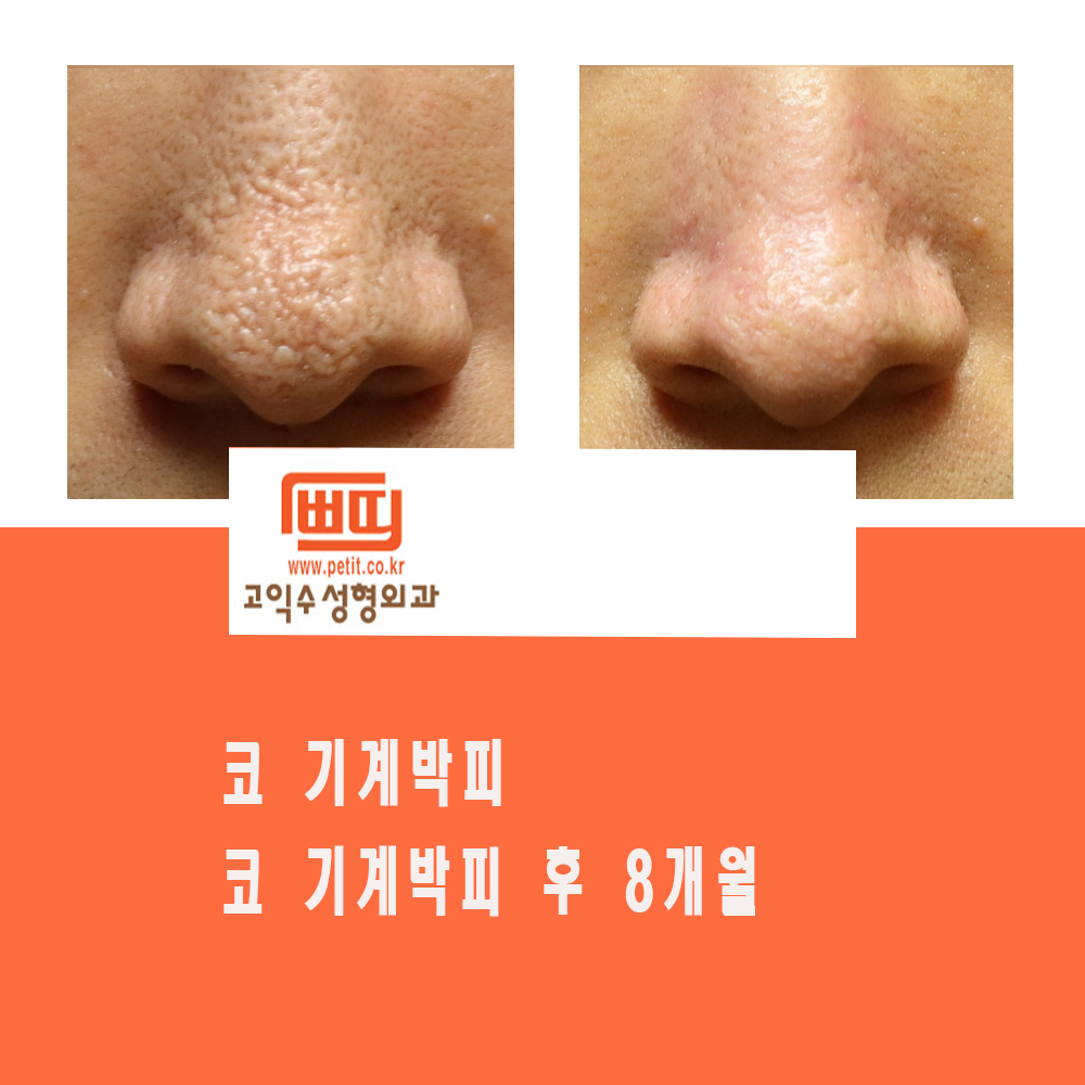 고익수성형외과 대표 이미지