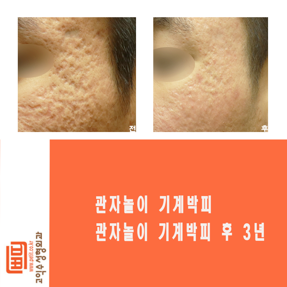 고익수성형외과 대표 이미지