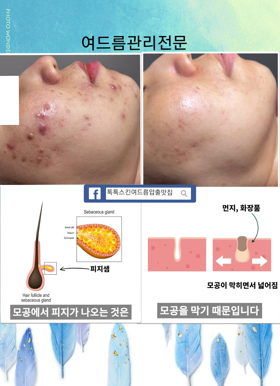 톡톡스킨 고양시본점 대표 이미지