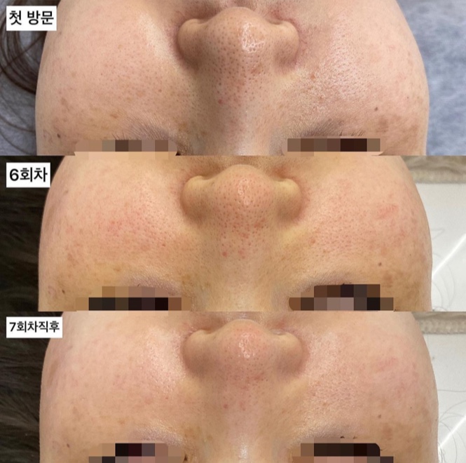 하베레피부전문센터