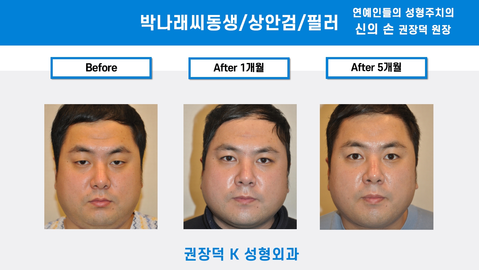 권장덕K성형외과의원