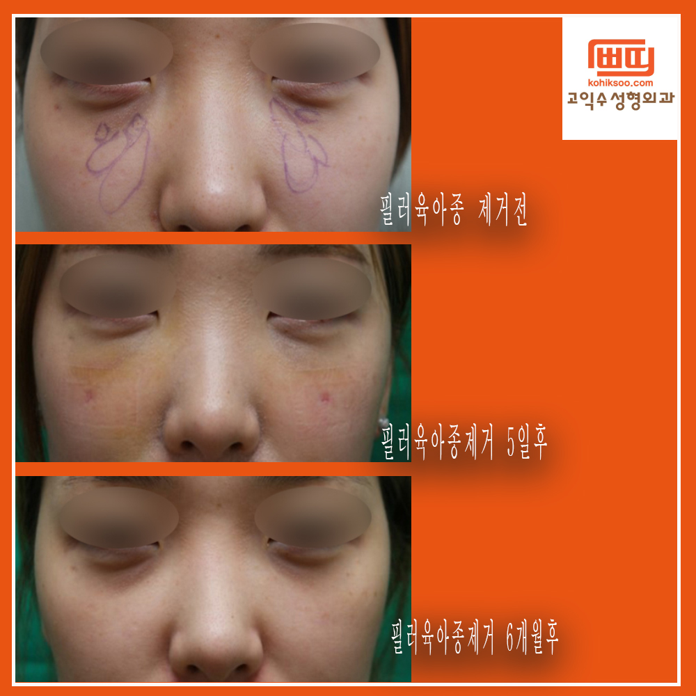 고익수성형외과 대표 이미지