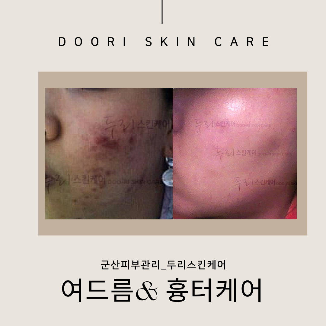 두리스킨케어