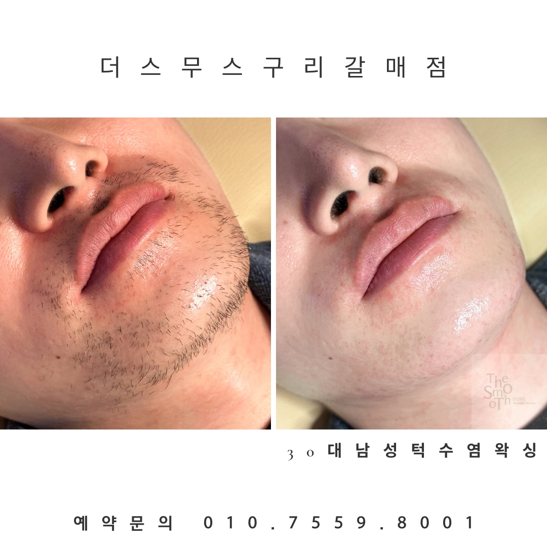 더스무스 왁싱피부 구리갈매점