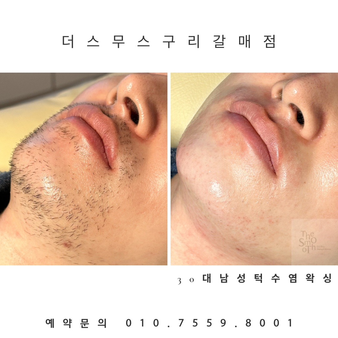 더스무스 왁싱피부 구리갈매점