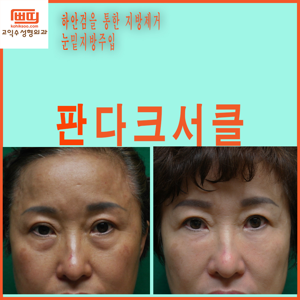 고익수성형외과의원 대표 이미지