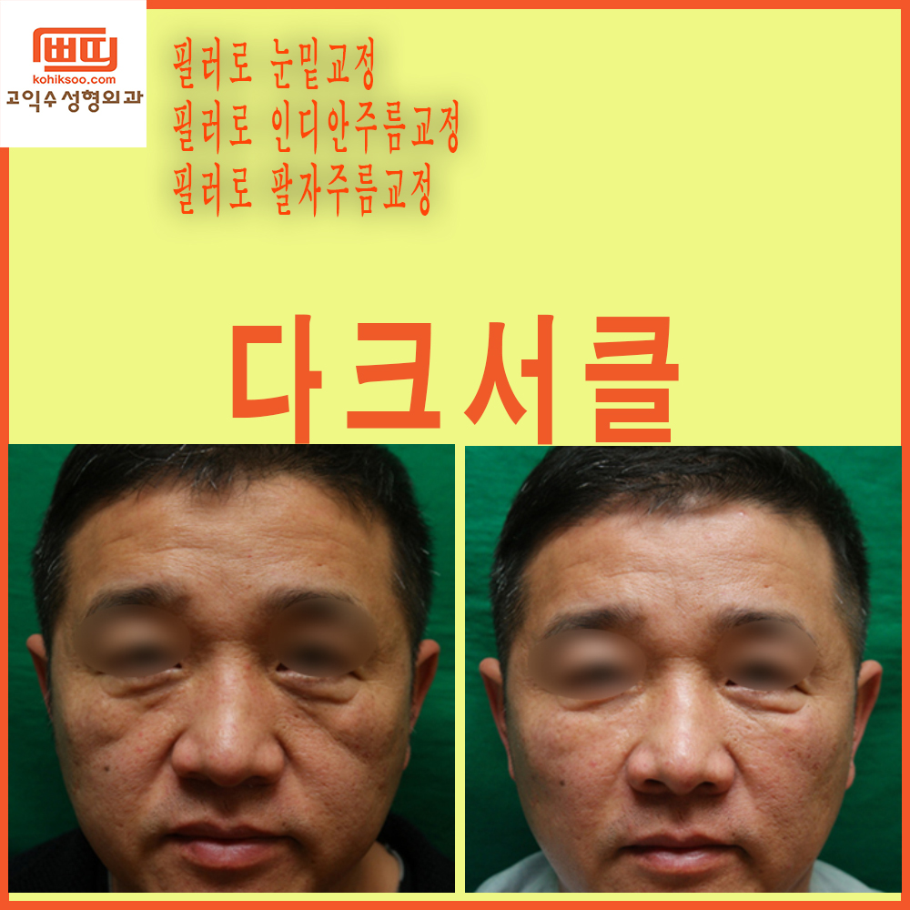 고익수성형외과 대표 이미지