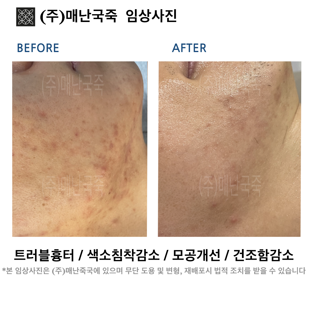 단미스킨앤바디