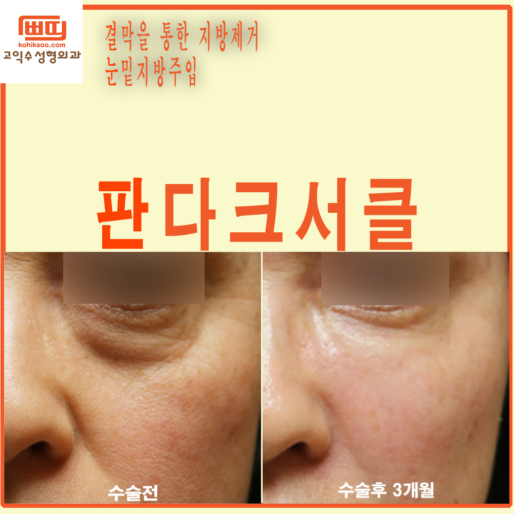 고익수성형외과의원 대표 이미지
