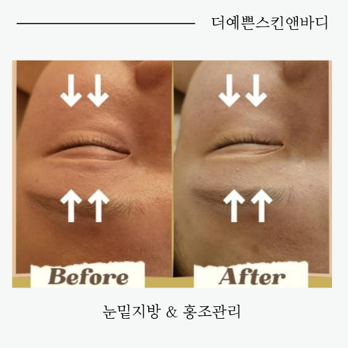 더예쁜스킨앤바디